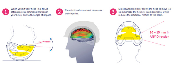 MIPS technology - impact