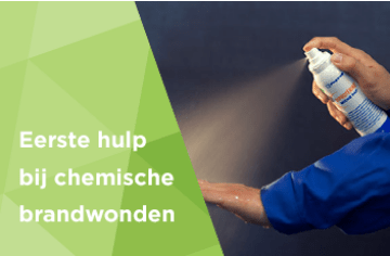 Eerste hulp bij chemische brandwonden